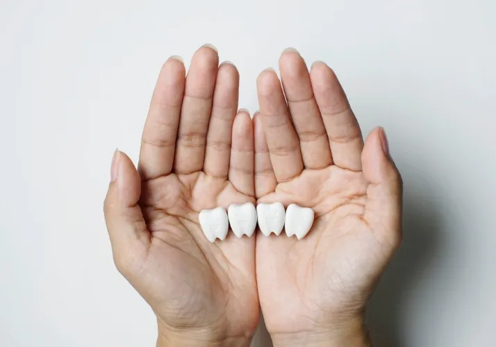 Des extractions qui s’imposent parfois