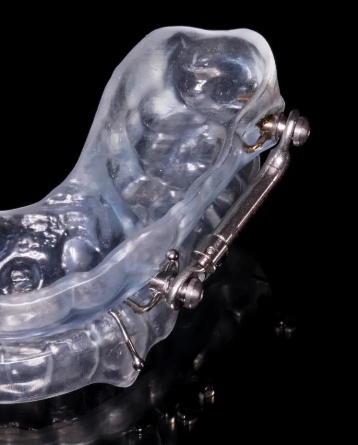 Des solutions possibles chez votre dentiste