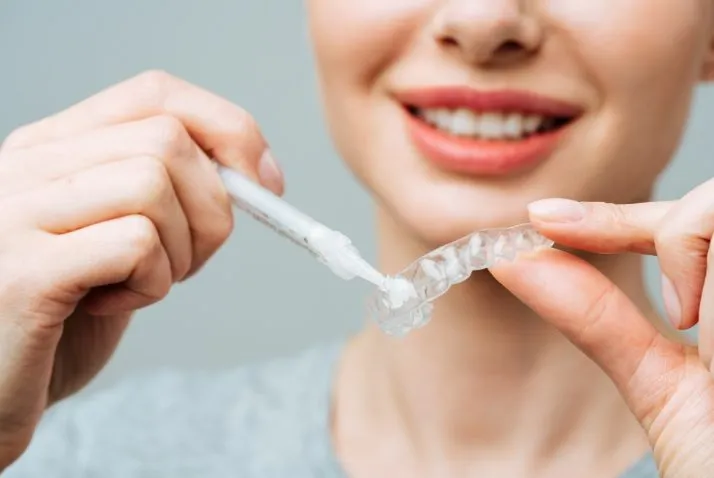 Blanchiment : quand peut-on y recourir ?